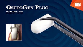 OsteoGen® Plug | One step bone grafting solution screenshot 4