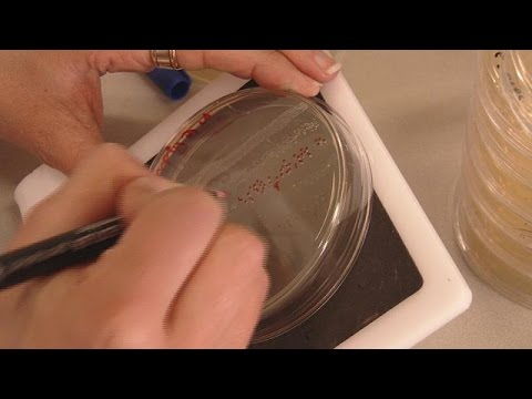 Video: La Donna è Stata Uccisa Da Un Batterio Resistente A Tutti Gli Antibiotici Conosciuti - Visualizzazione Alternativa