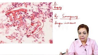 Mucormycosis | Edition 8 Sample Video (Microbiology)