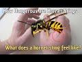 How Dangerous are Hornet Stings? 🐝 What does a hornet sting feel like? how painful is a hornet sting