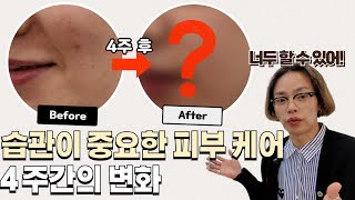 피부 개선 프로젝트!! 원래 나빴던 피부는 없다!! 피부과 전문의, 화장품 연구원 선생님 총출동~~!!