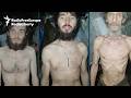 Shocking Images Reveal Food Crisis On Ukraine's Front Lines