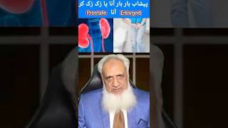 Prostate Enlarge Hona—Urine Ruk Ruk Kar Ana#prostate #prostatecancer #urinedroping #urine #drakhtar
