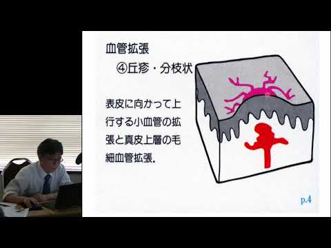 2019年6月2日  #553　「午前の部」『実地医家のための　皮膚所見の基本！　紅斑を生じる疾患－その診断と治療のポイント』（齋藤典充先生）1