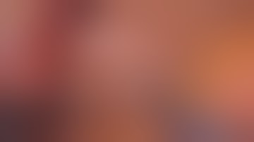 Robotic Inguinal Hernia Instructional Video