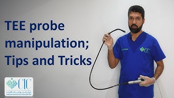 TEE (TOE) probe manipulation; tips and tricks