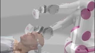 ROSA ONE Brain Overview