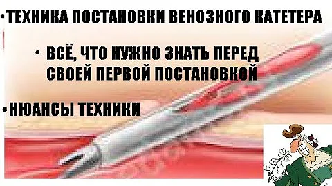 Периферический венозный катетер: техника постановки и всё, что новичку хотелось бы знать об этом