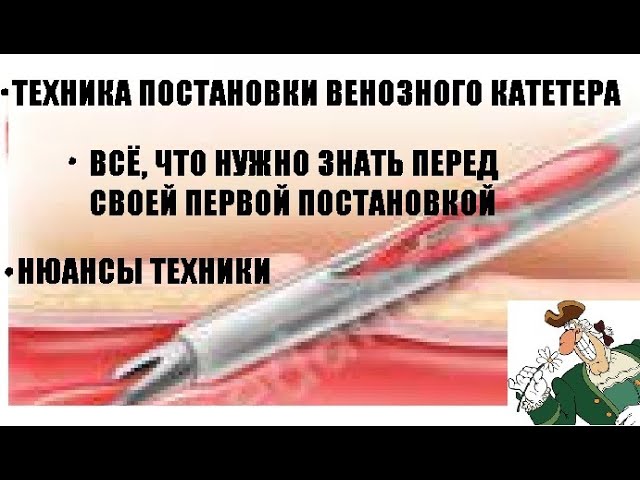 Периферический венозный катетер: техника постановки и всё, что новичку хотелось бы знать об этом