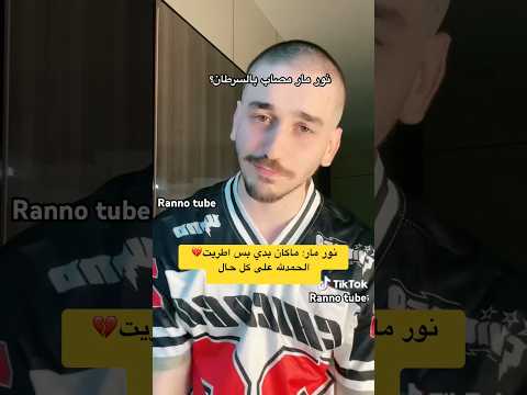 نور مار مصاب بالسرطان صدمه نور مار اكسبلور