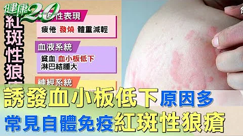 诱发血小板低下原因多 常见自体免疫红斑性狼疮 健康2.0 - 天天要闻