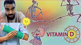 شماعة بعض الأطباء  فيتامين د vitamin D