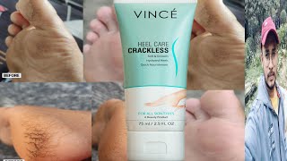 Vince Crackless Heel Care Honest Review