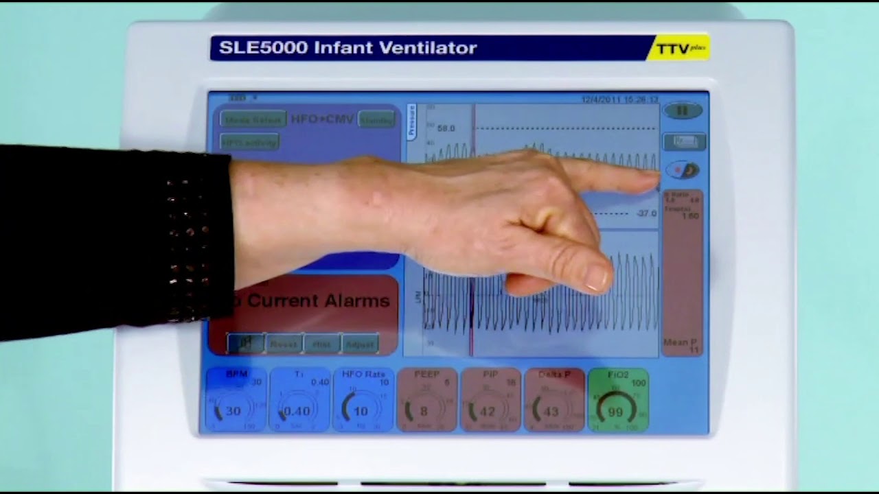 SLE5000 | 16. HFOV + CMV