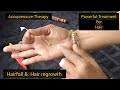 Acupressure for hair growth hairfall dandruff removal hair regain hairfall hair nhwithrekha