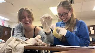 Forensic Lab #1: accidentally found blood on the shirt