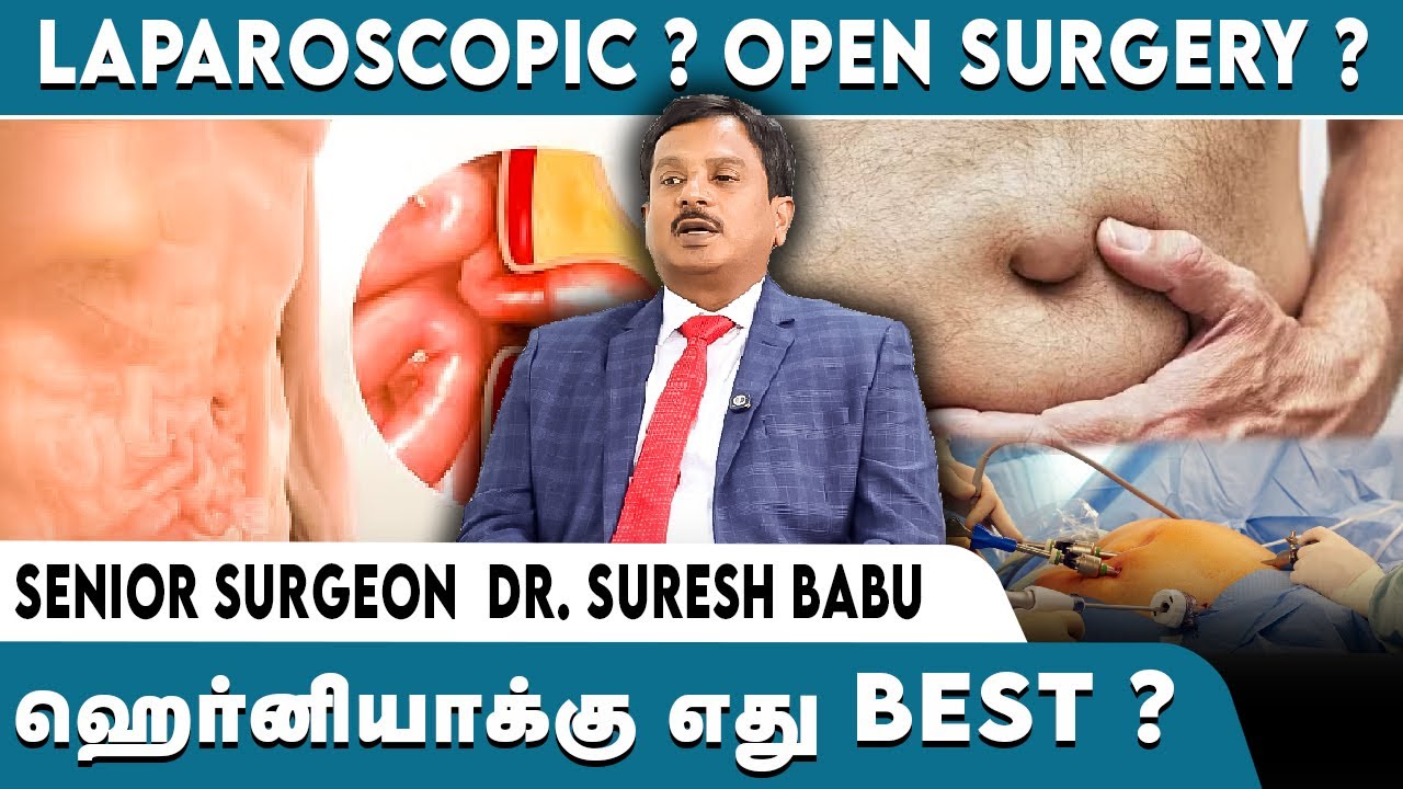 Laparoscopic hernia surgery vs Open hernia surgery | ஹெர்னியாவிற்கு எது சிறந்தது?| Dr Suresh Babu