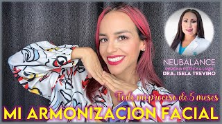 Todo sobre mi Armonización Facial | NEUBALANCE Medicina Estética &amp; Láser | Silviad8a