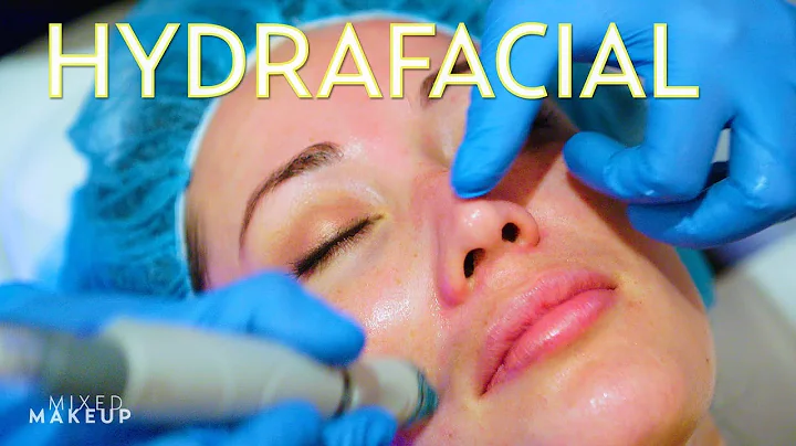 What is a Hydrafacial Treatment + Our Review! | Th...