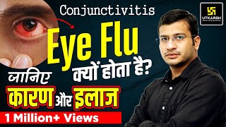 Eye Flu : Conjunctivitis यानी Eye Flu क्यों होता है Cause, Prevention & Treatment By Siddharth Sir