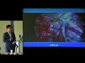 2019 think tank techniques to improve syrinx after chiari decompression  anthony wang md