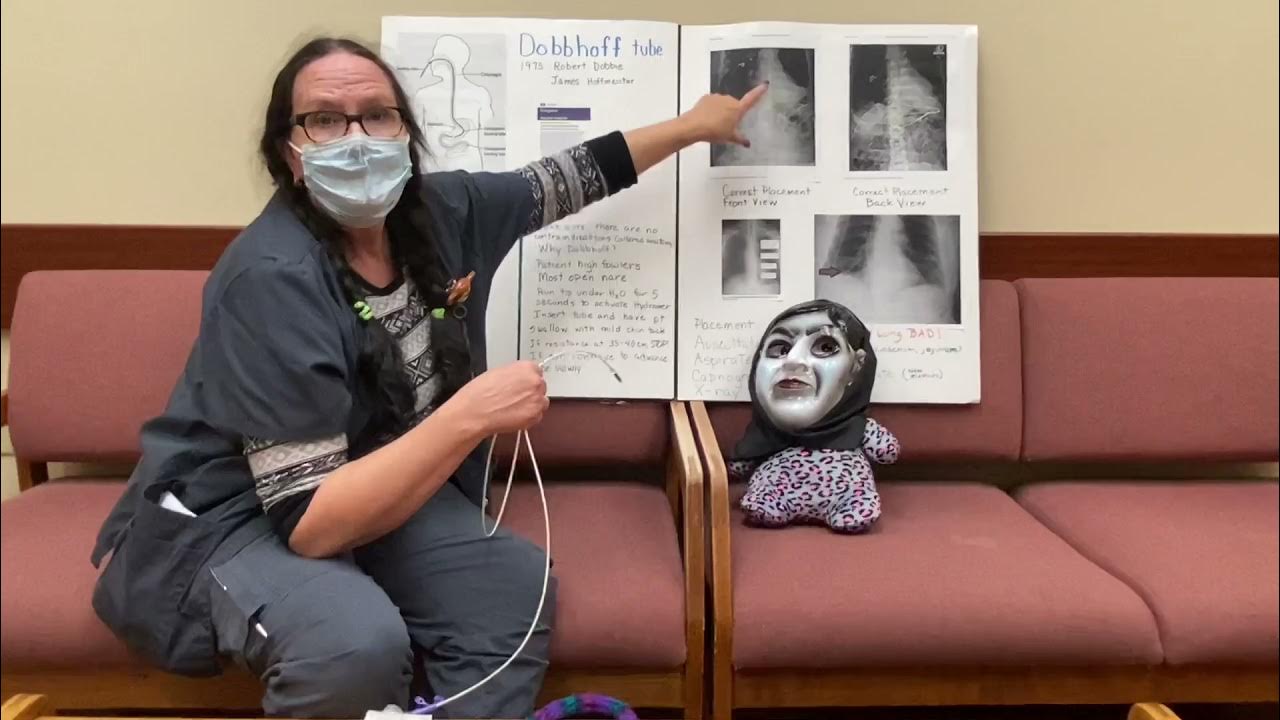 Dobhoff placement YouTube