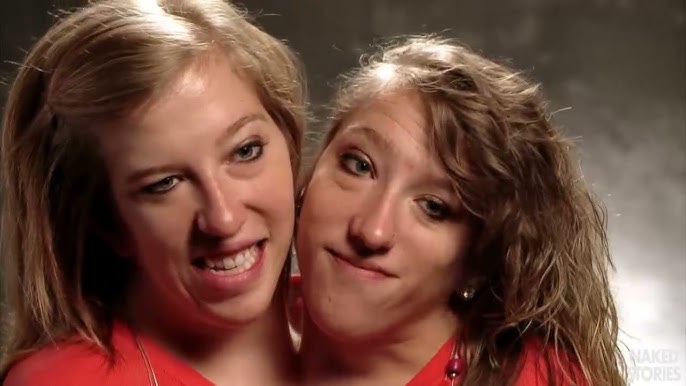 Abigail & Brittany Hensel - The Twins Who Share a Body - video Dailymotion