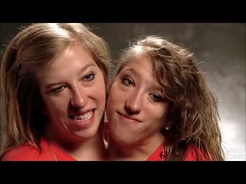 Abby and Brittany Hensel: Conjoined Twins - Quick Q&A