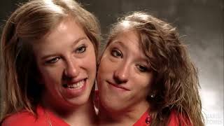 Knovhov TV on X: Abby and Brittany Hensel: Conjoined twins are very rare  in the world. Since they have two brains, they should be regarded as two  separate participants in examinations and