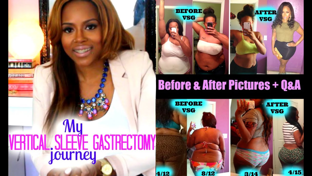 Fat burner gel como usar photo 10