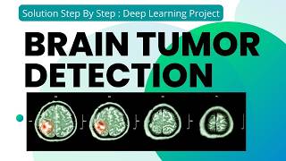 Brain tumor detection system Using Deep learning neural networks