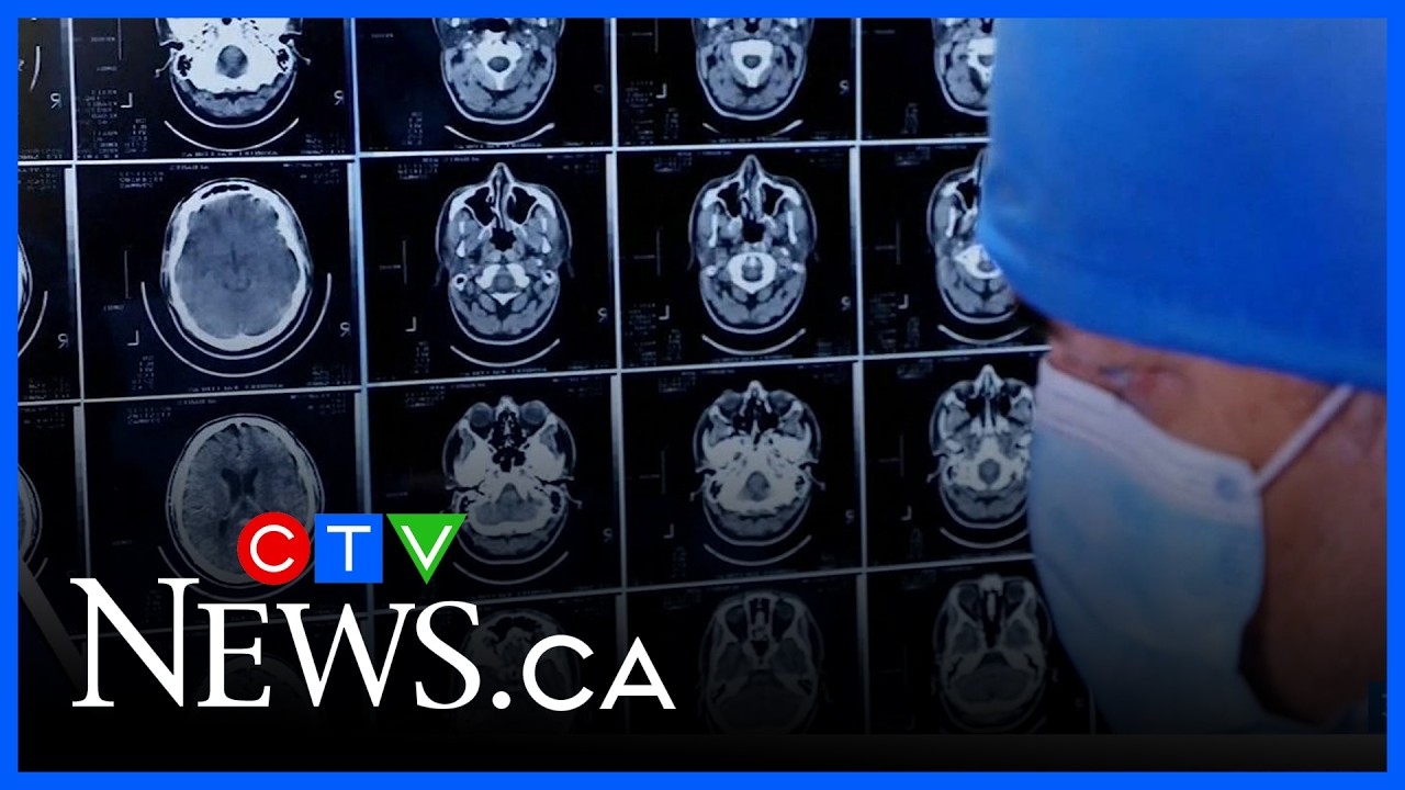Targeted Drug Development for Brain Cancer Metastasis Prevention