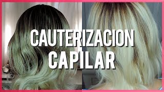 ¿Cómo se aplica la Cauterizacion capilar?