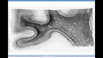 Robert Turner: The living cortex, in depth