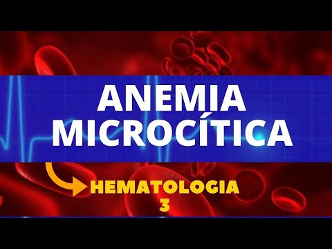Vídeo: Anemia Microcítica - Causas, Sintomas E Tratamento