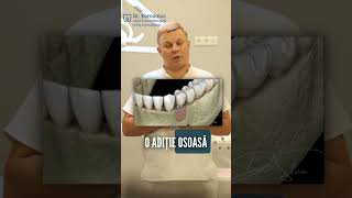 Factorii care influențează prețul unei danturi fixe