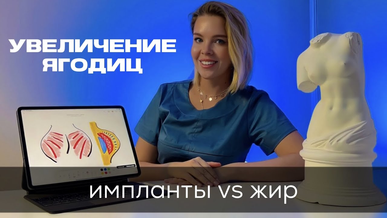 УВЕЛИЧЕНИЕ ЯГОДИЦ. ЧТО ВЫБРАТЬ: ИМПЛАНТЫ ИЛИ ЖИР? - YouTube