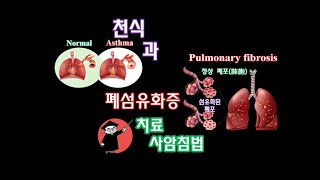 1133: Making a Sand Acupuncture Needle - Sand Acupuncture for Asthma and Pulmonary Fibrosis