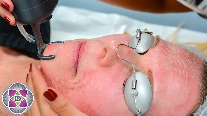 The Science of Erbium and CO2 Fractional Laser Resurfacing