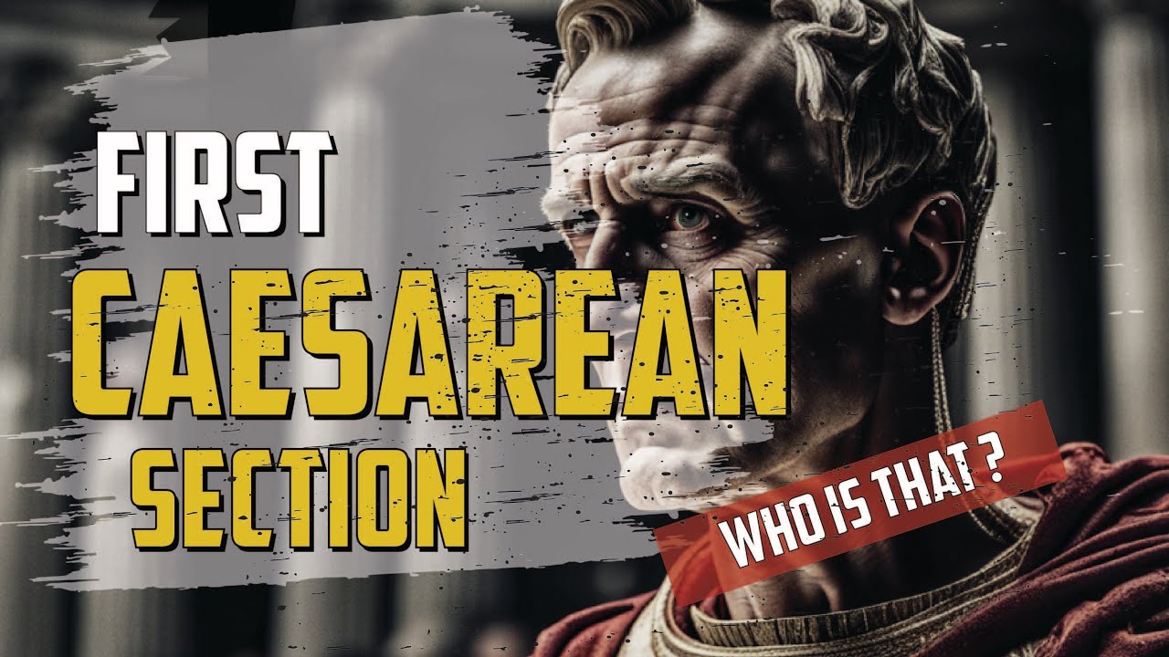 The First Caesarean Section | Julius Caesar | Buzz Plum