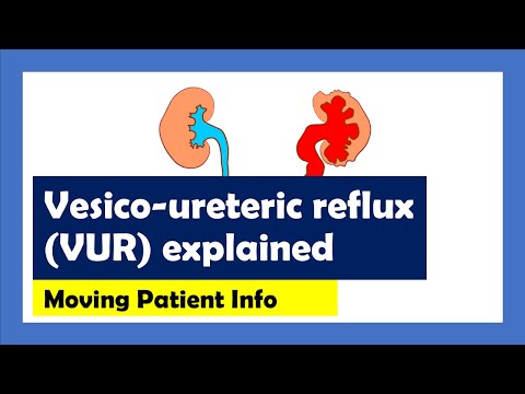 Vesico-ureteric reflux explained... animated patient info