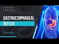 Gastroesophageal reflux   dr amit mathur