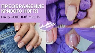 видео: Преображение деформированного ногтя. Натуральный френч на ногтях. Ремонт ногтей. картинка: Преображение деформированного ногтя. Натуральный френч на ногтях. Ремонт ногтей.