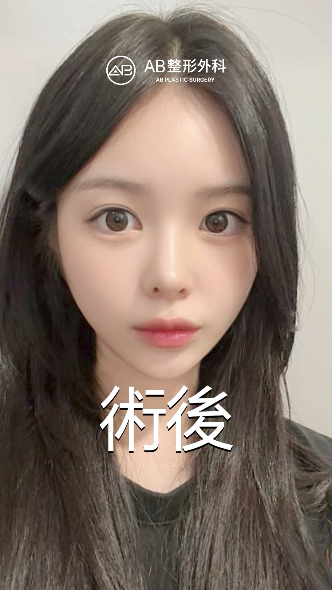 線條太順了！完美小臉誕生✨ #shorts