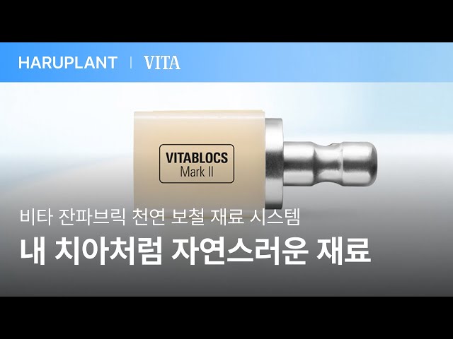 자연에서 온 최고 품질의 독일 비타 잔파브릭 천연 보철 재료를 사용하는 하루플란트치과