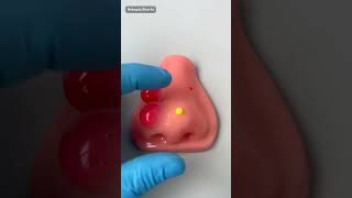 Squishy Stress Relieving Fidget Toy! Satisfying Pimple Popping ASMR 🤢... #Shorts