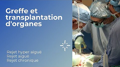 Les mcanismes du rejet en transplantation et greffe d'organes.