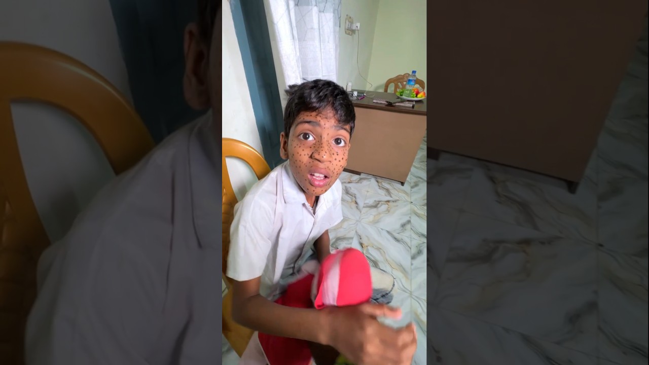 মুখে এসব কি হয়েছে 😱#bayazid0007 #trending #hasbunallohstv #baizedmahmud #emotional