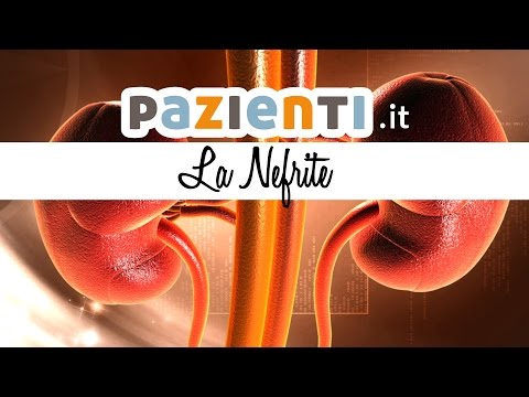 Video: Nefrite (infiammazione Dei Reni) - Cause E Sintomi Di Nefrite, Trattamento Della Nefrite