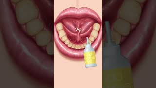 Teeth cleaning #asmr #animation #deepcleansing #shorts #shortsfeed